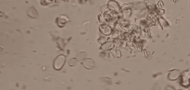 microscopic fungus